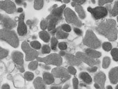 mycoplasma
