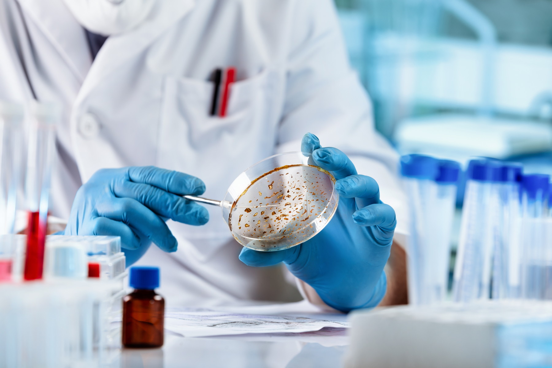 Bakterie způsobující úplavici mění způsob šíření. Nebezpečná shigelóza se stává sexuálně přenosnou infekcí a odolává antibiotikům