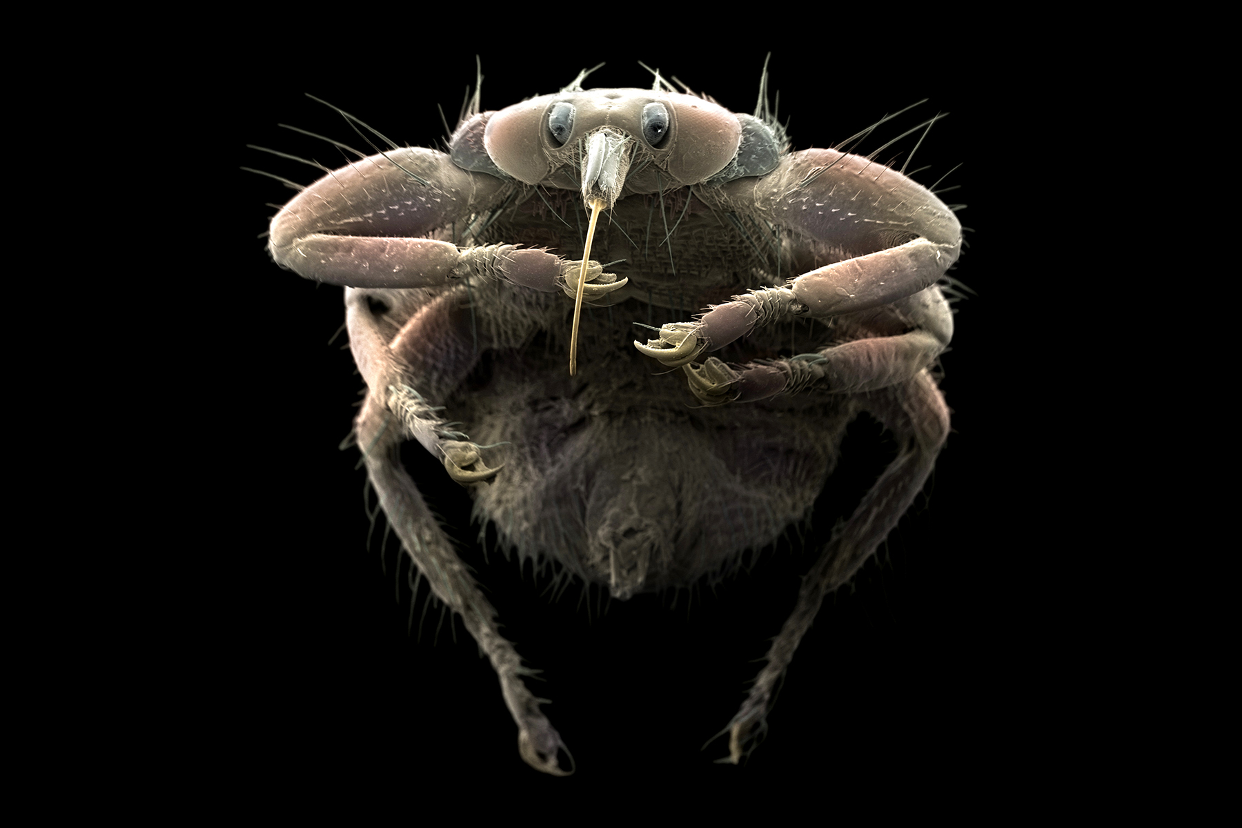 Nebezpeční černí pasažéři: Jak vypadají blechy, škrkavky a tasemnice pod lupou