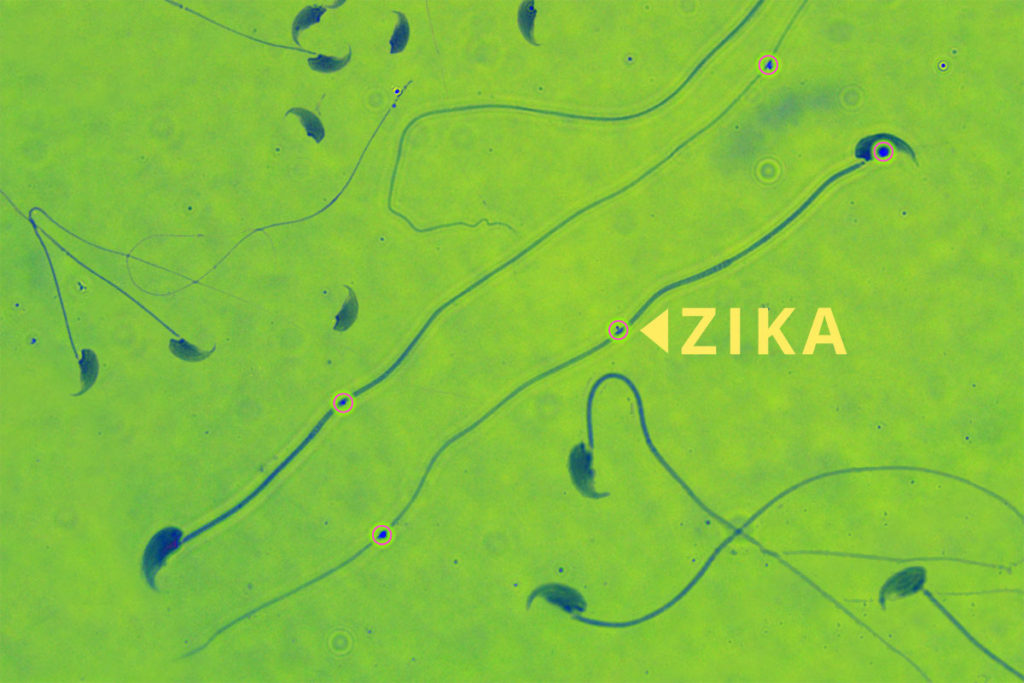 Zika v samci