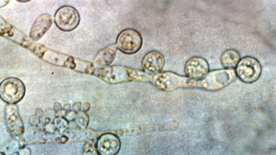 Candida