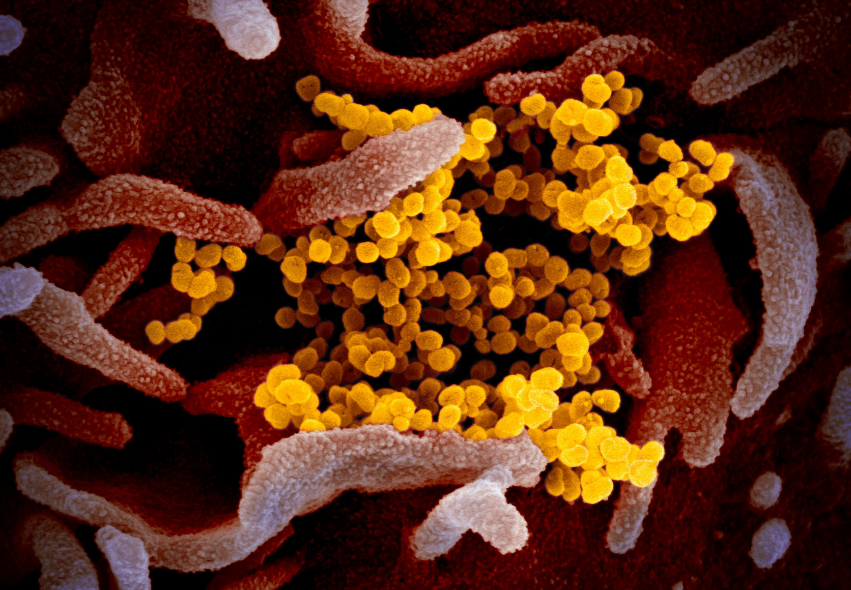 Zaost eno Na Viry Jak Vypad Koronavirus Ebola Nebo HIV Pod 