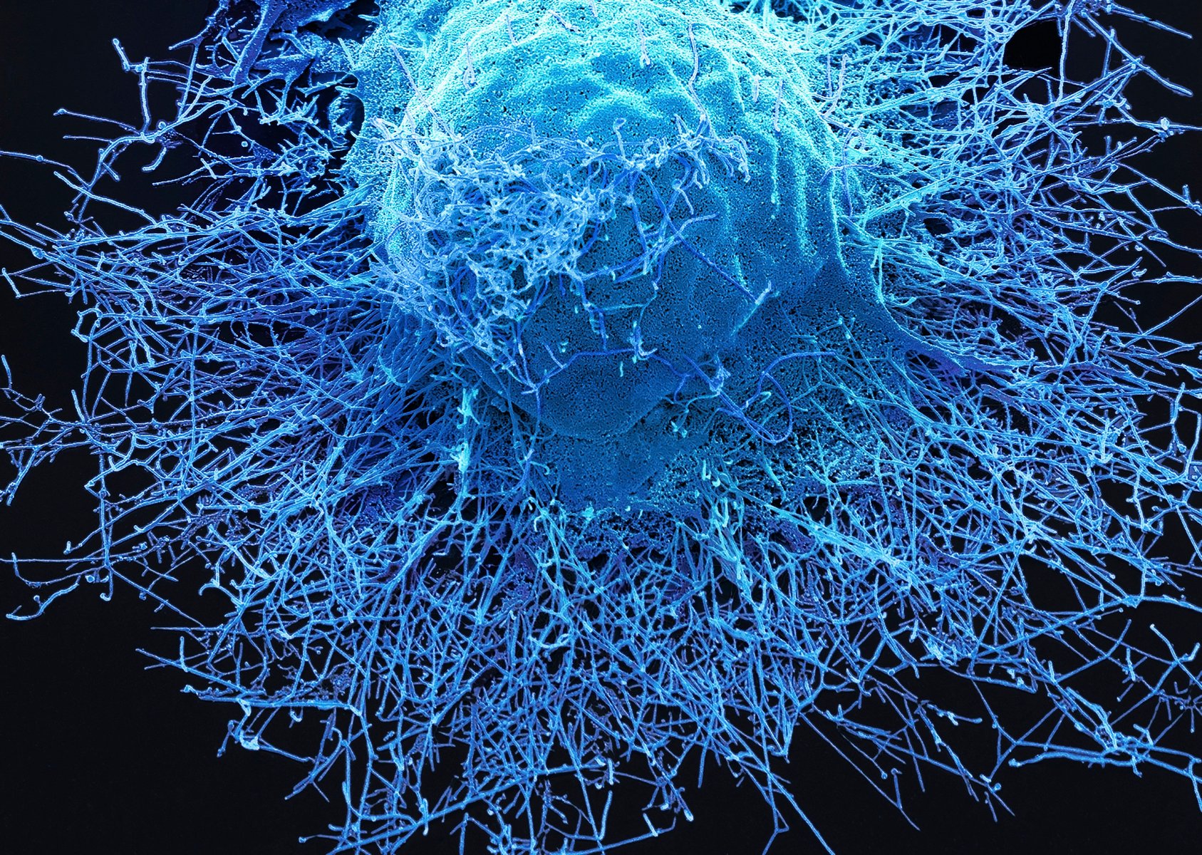 Zaost eno Na Viry Jak Vypad Koronavirus Ebola Nebo HIV Pod 