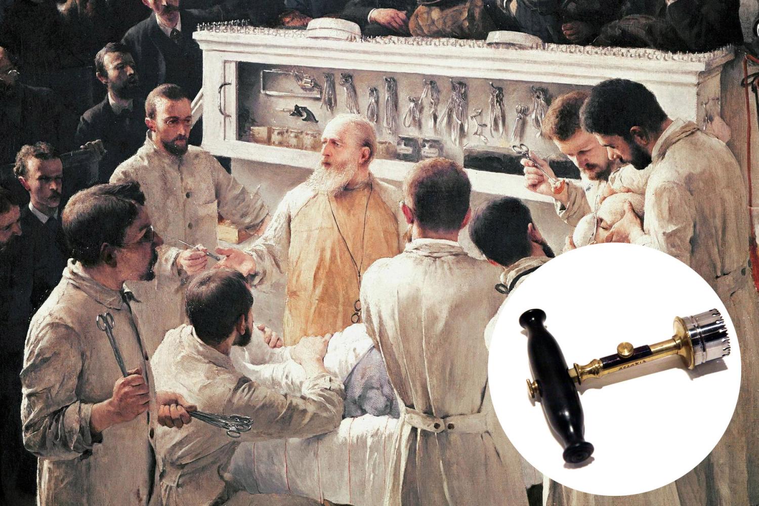 <p>Trepan představoval speciální zařízení s kruhovou čepelí, na kterou navazovala rukojeť. Po přiložení k dané části těla držel přístroj na místě pomocí zářezů na krytce, zatímco lékař otáčel rukojetí, jež pod tlakem pronikala do tkáně.</p>