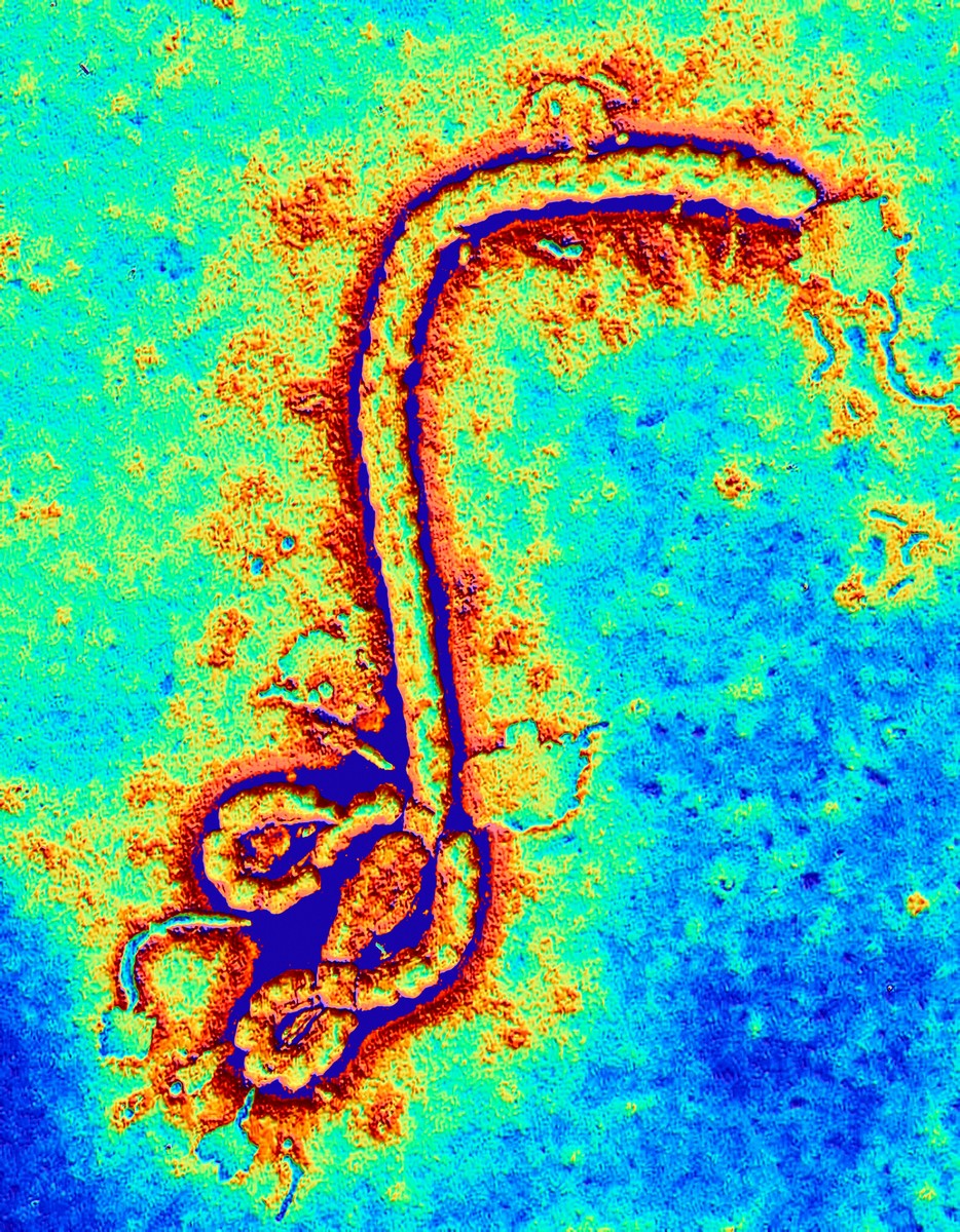Ebola -<p>Virus ebola napadá kromě lidí i některé další primáty. Přenáší se kontaktem s nakaženou krví či jinými tělními tekutinami.</p>