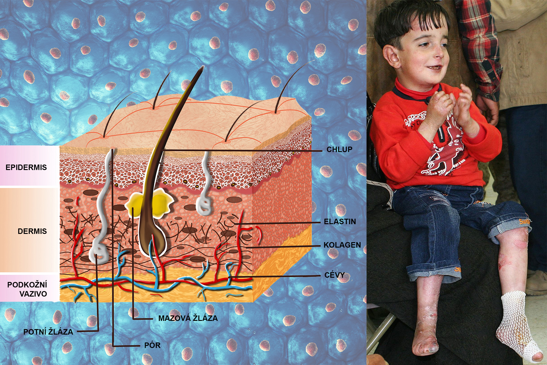 <p>Lidská kůže se skládá ze tří vrstev: pokožky (epidermis), škáry (dermis) a podkožního vaziva. Kromě ochranné role, kdy odděluje vnitřní prostředí organismu od vnějšího prostředí a chrání tak před mikroorganismy, škodlivými látkami a UV zářením, má i řadu dalších funkcí, například smyslovou, termoregulační a podobně.</p>