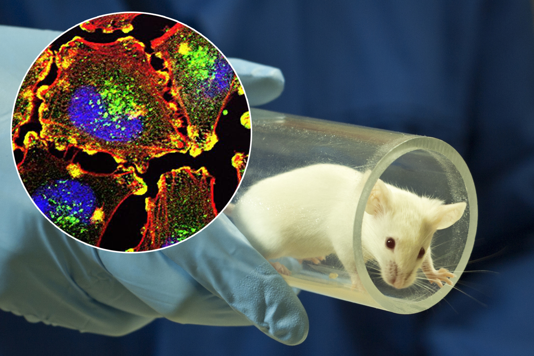 <p>Ve výřezu buňky metastazujícího melanomu.</p>