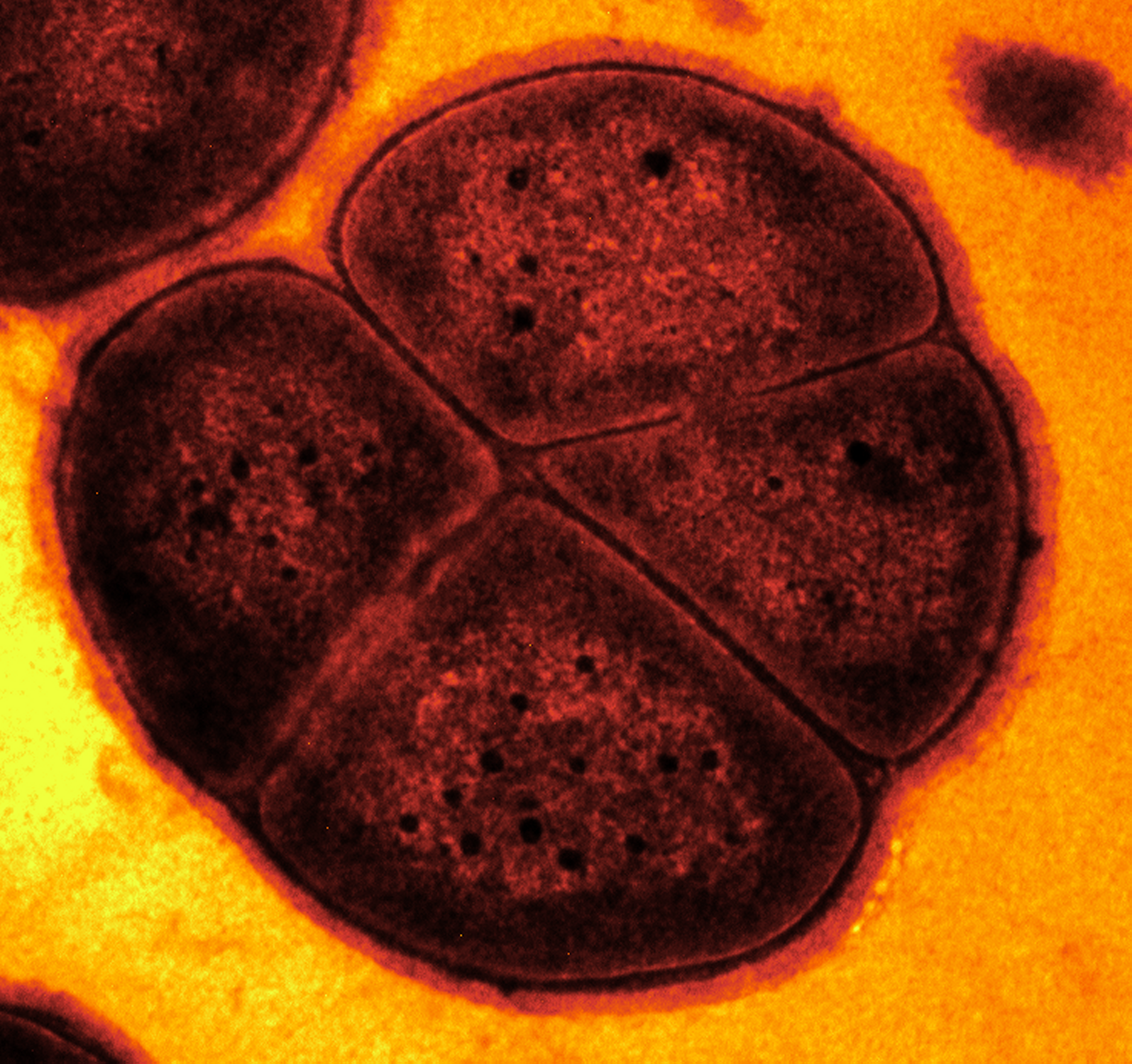 <p>Bakterie <em>Deinococcus radiodurans</em> okem elektronového mikroskopu.</p>