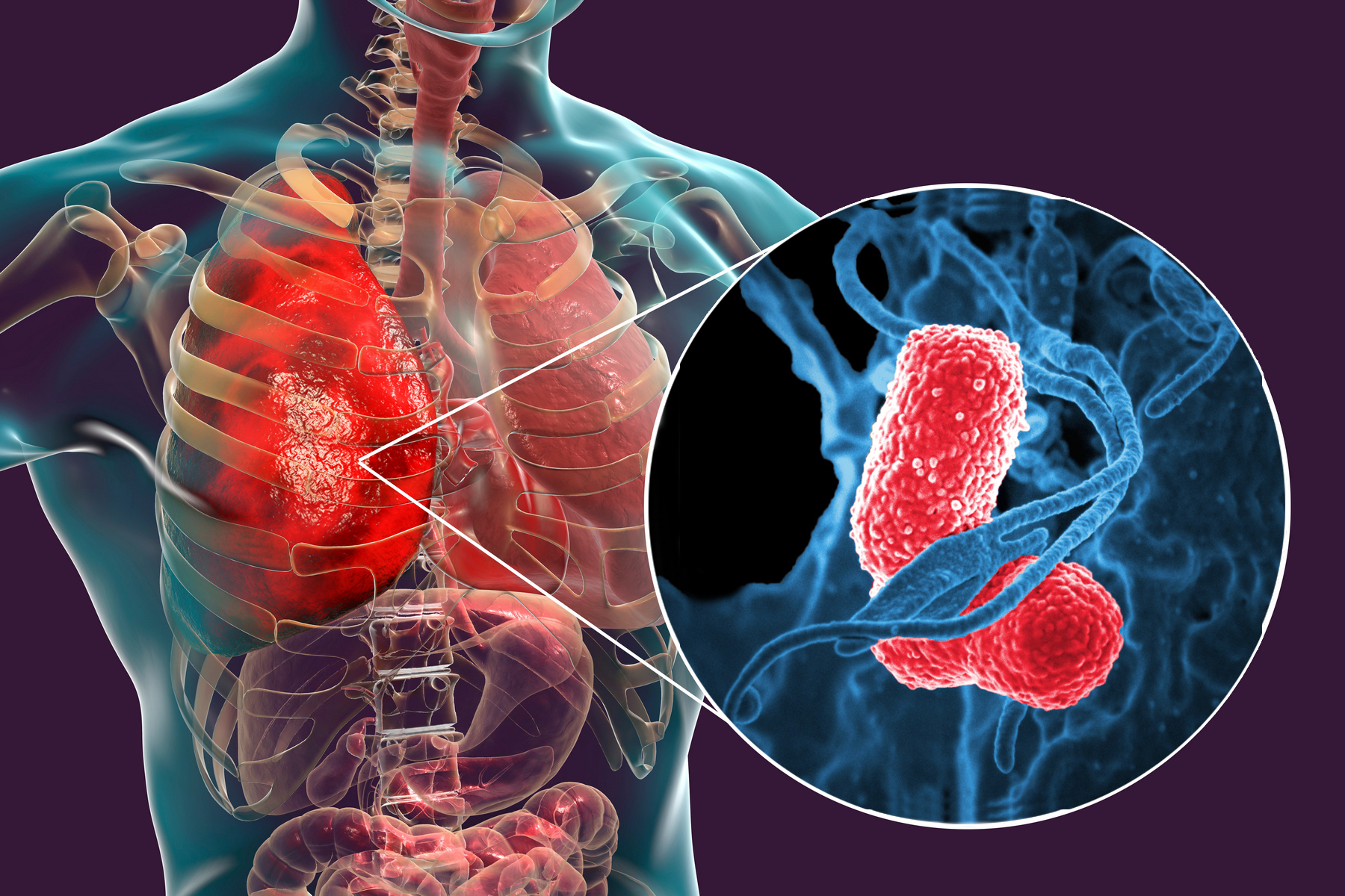 <p>Ve výřezu rezistentní bakterie <em>Klebsiella pneumoniae</em> na snímku rastrovacího elektronového mikroskopu.</p>
