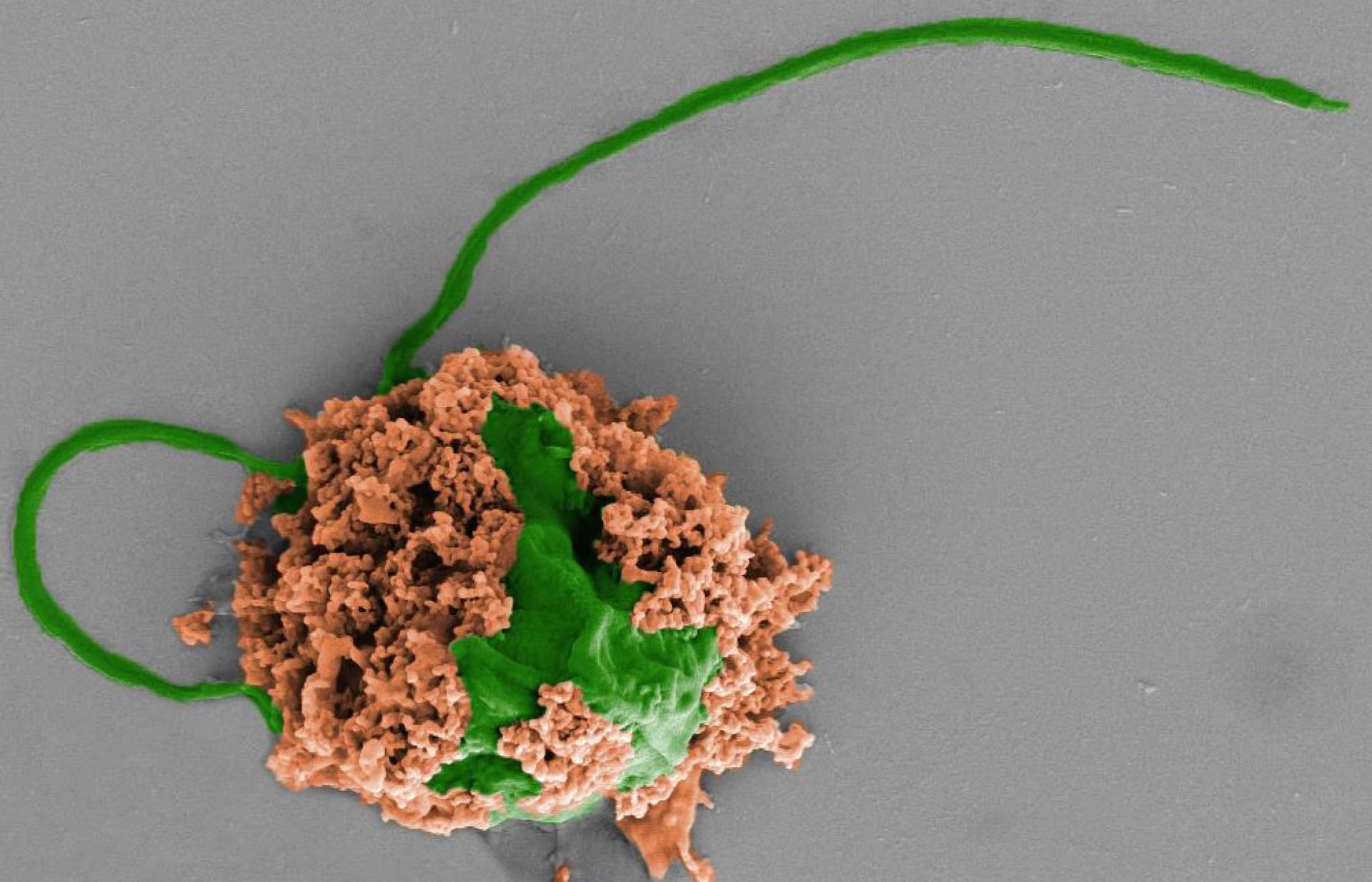 <p>Chlamydomonáda ve „skafandru“ na snímku z rastrovacího elektronového mikroskopu. <em>(foto: UC San Diego, Fangyu Zhang, Zhengxing Li, CC BY 4.0)</em></p>