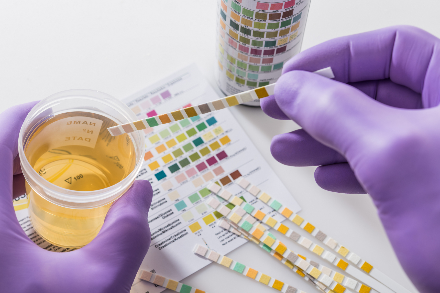 <p>Biologické poločasy nejrozšířenějších drog jsou poměrně krátké. V moči lze ale detekovat metabolity drog někdy i za dlouhé týdny. <em>(foto: Shutterstock)</em></p>