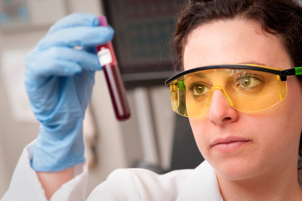 Krevní test - 