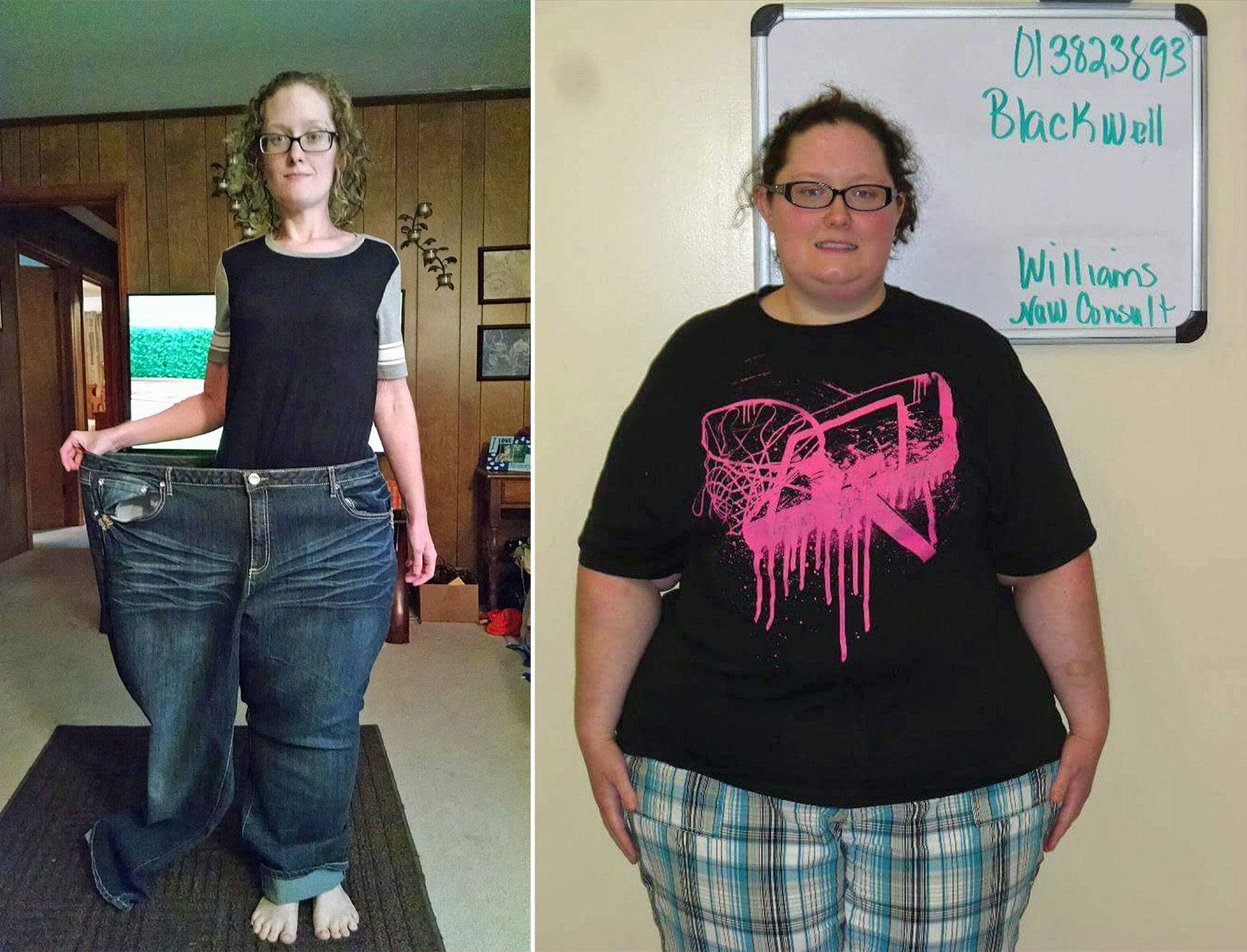 Crystal Blackwell před operací a po ní -<p>Mladá Američanka po operaci  žaludku zhubla o rovných 100 kilogramů.</p>
